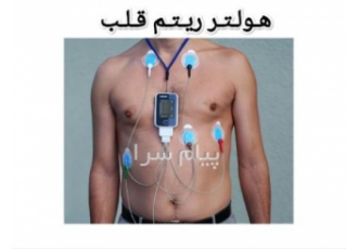 اجاره هولتر ریتم قلب در مشهد اجاره هولتر قلب در مشهد بعد از 24 تا 48