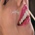 کامپوزیت و لمینت دندان در خیابان شریعتی تهران کامپوزیت و لمینت دندان