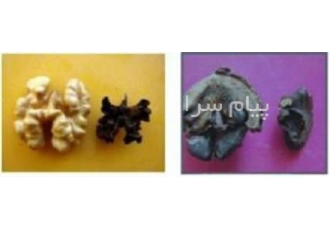 دفع کامل کرم خراط و رفع سیاه شدن مغز گردو