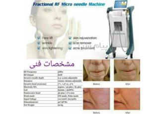 خرید و فروش دستگاه آراف فرکشنال لیفت و جوانسازی RF دستگاه آراف فرکشنال