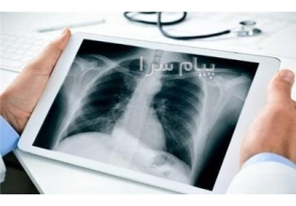 خریدار فیلم آکبند و مصرف شده رادیولوژی و لیتوگرافی در تهران تامین